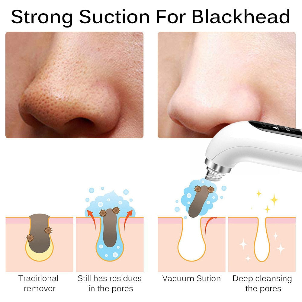 BlackPluss - Blackhead Remover Pore Vacuum Face Cleaner Electric Pimple.