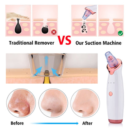 BlackPluss - Electric Facial Blackhead Remover Vacuum Pore Cleaner Acne