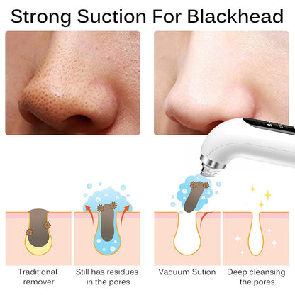 BlackPluss - Blackhead Remover Pore Vacuum Face Cleaner Electric Pimple.